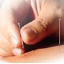 acupuncture1.jpg